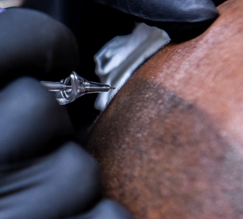 Micropigmentation
