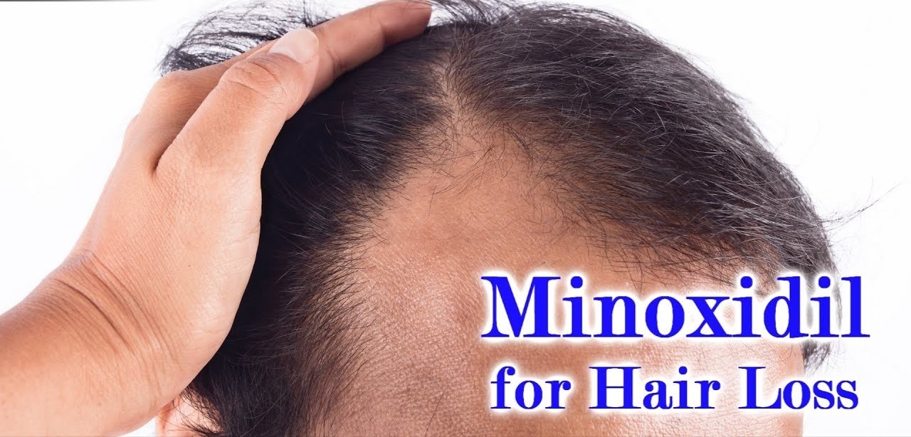 Taking Minoxidil for Hair Loss: Pros and Cons for Alopecia